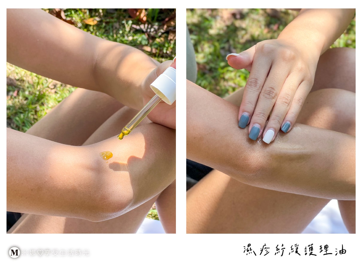 濕疹紓緩護理油 肌膚吸收快速不油膩